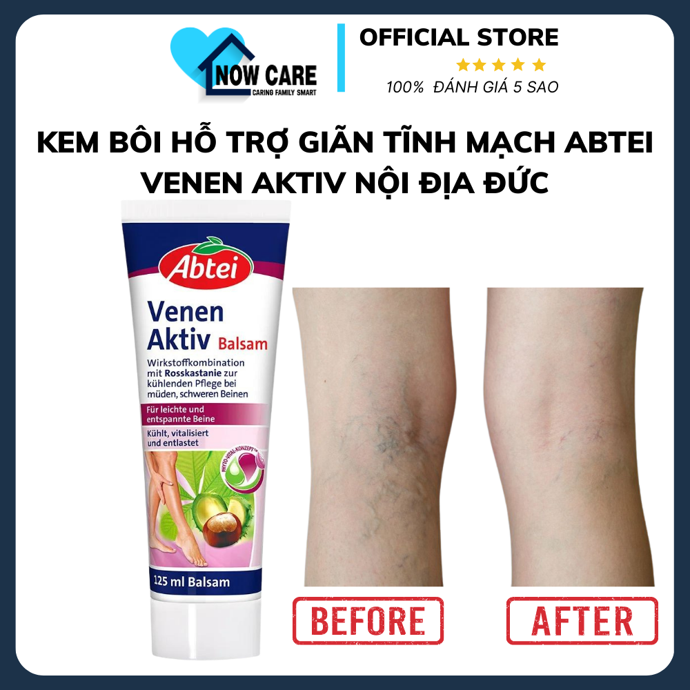 Kem Bôi Giãn Tĩnh Mạch Venen Aktiv 125ml – Abtei